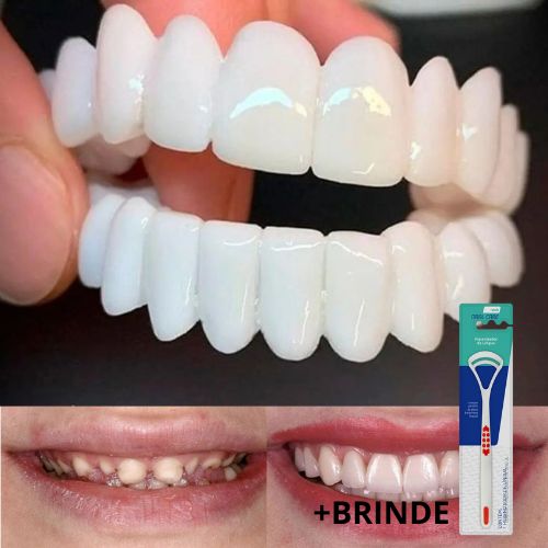 Kit com 2 Placas Dentais de Cerâmica Brancas – PARA TODAS ARCARIAS – Sorriso Perfeito com Praticidade