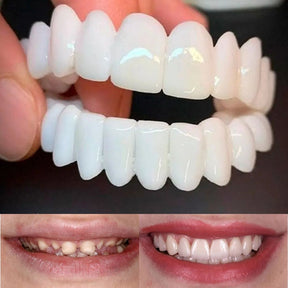 Kit com 2 Placas Dentais de Cerâmica Brancas – PARA TODAS ARCARIAS – Sorriso Perfeito com Praticidade