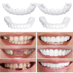 Kit com 2 Placas Dentais de Cerâmica Brancas – PARA TODAS ARCARIAS – Sorriso Perfeito com Praticidade